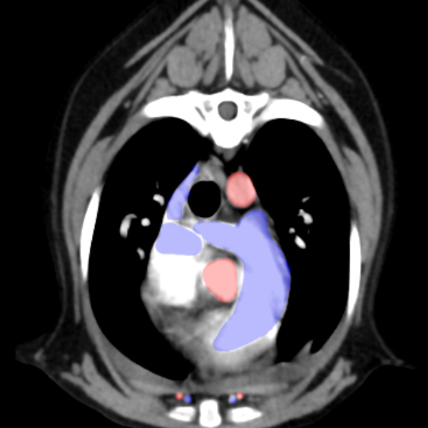 Anatomia Vascular por Tomografia Computadorizada